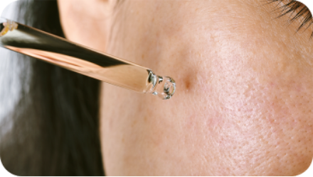 LifeCell Scar Serum – 30ml - SweetestSaffron